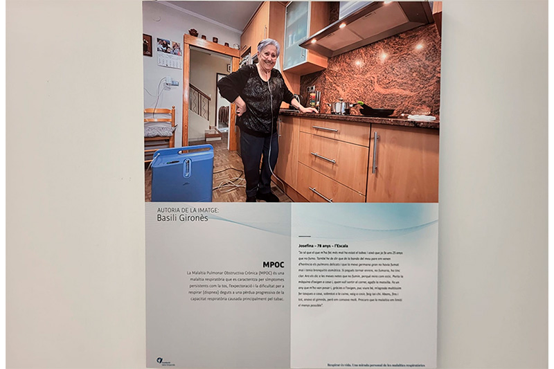 Exposició “Respirar és vida. Una mirada personal de les malalties respiratòries” al CAP de l'Escala